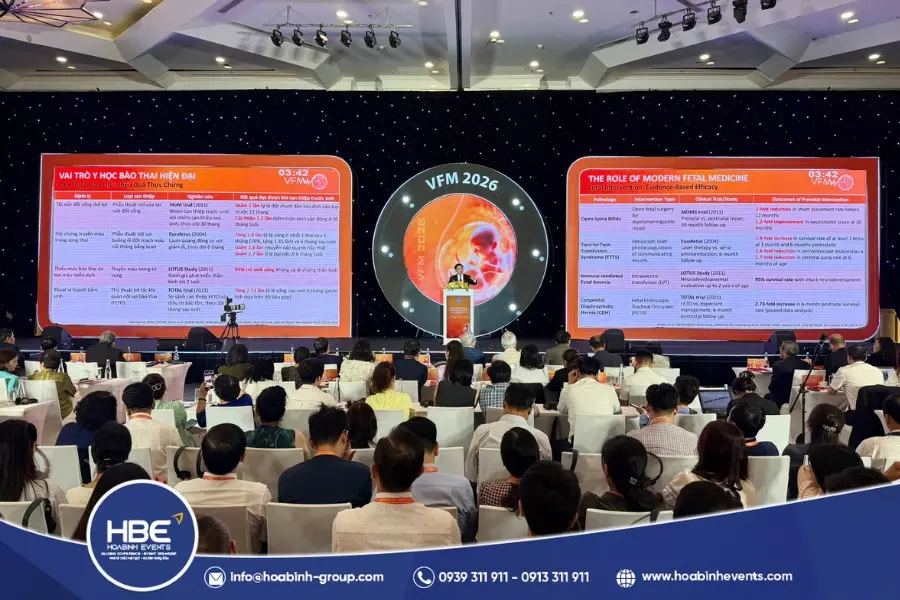 Các yếu tố cần xem xét khi xác định kích thước sân khấu Các yếu tố cần xem xét khi xác định kích thước sân khấu